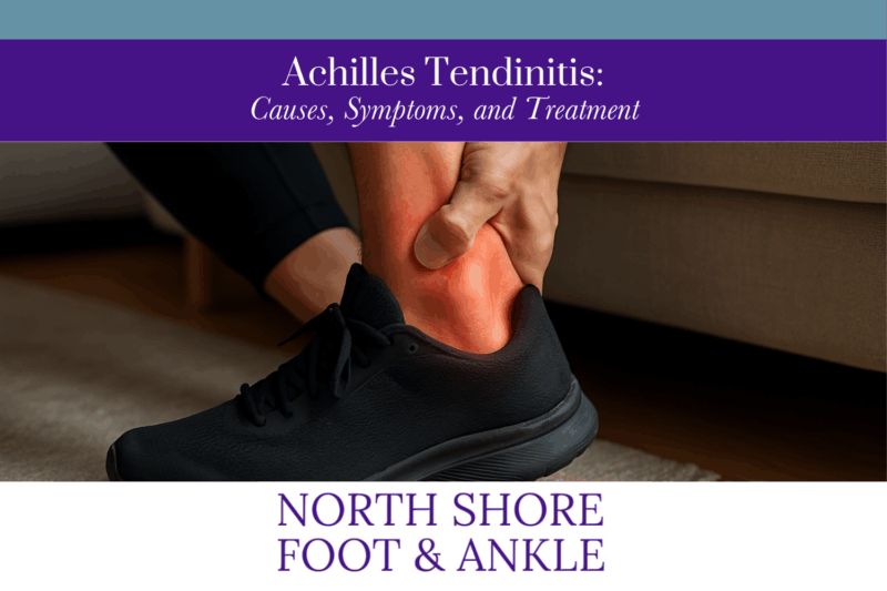 Achilles Tendinitis Causes, Symptoms, and Treatment
